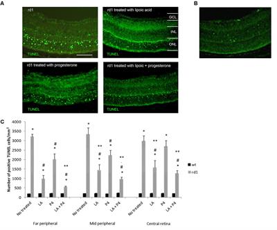 <mark class="highlighted">Lipoic Acid</mark> and Progesterone Alone or in Combination Ameliorate Retinal Degeneration in an Experimental Model of Hereditary Retinal Degeneration